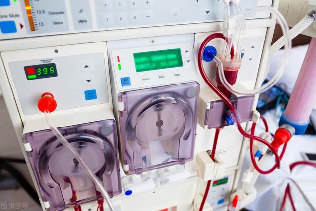 Why Choose the Peristaltic Pump in Dialysis?